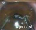 Wyci__ganie_robaka_z_oka