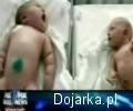 Ogromny_noworodek